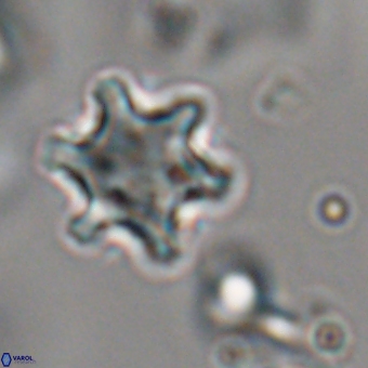 Discoaster sanmiguelensis 28555