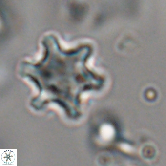 Discoaster sanmiguelensis 28555
