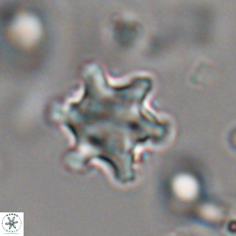 Discoaster sanmiguelensis 28556
