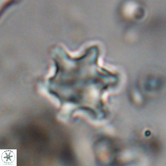 Discoaster sanmiguelensis 28557