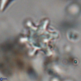 Discoaster sanmiguelensis 28558