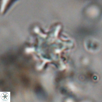 Discoaster sanmiguelensis 28558