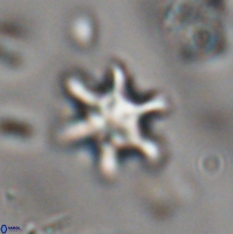 Discoaster sanmiguelensis 28550