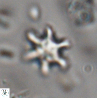 Discoaster sanmiguelensis 28550