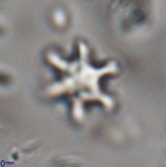 Discoaster sanmiguelensis 28551