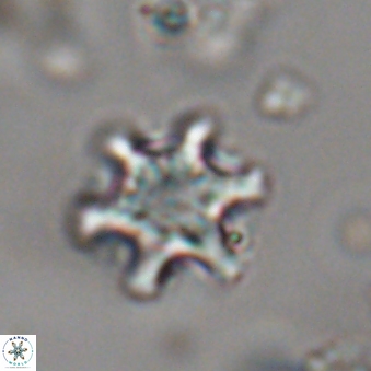 Discoaster sanmiguelensis 28553