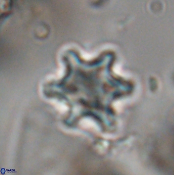 Discoaster sanmiguelensis 28560