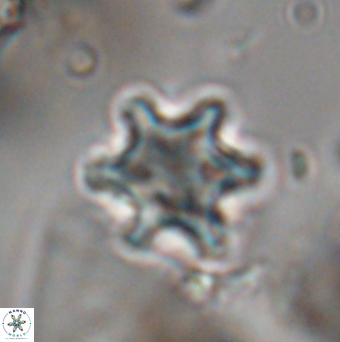 Discoaster sanmiguelensis 28560