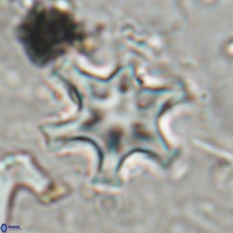 Discoaster sanmiguelensis 32219