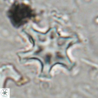 Discoaster sanmiguelensis 32219