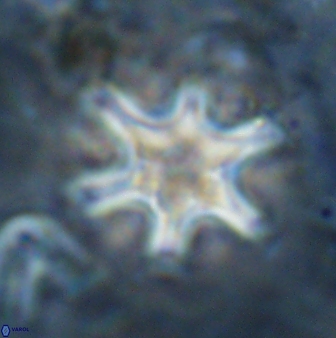 Discoaster sanmiguelensis 32225