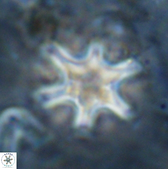 Discoaster sanmiguelensis 32225