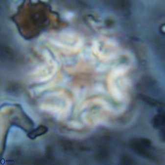 Discoaster sanmiguelensis 32226