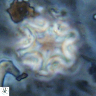Discoaster sanmiguelensis 32226