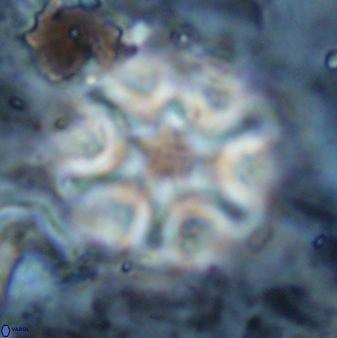 Discoaster sanmiguelensis 32227