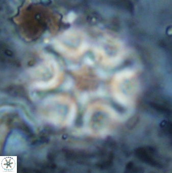 Discoaster sanmiguelensis 32227