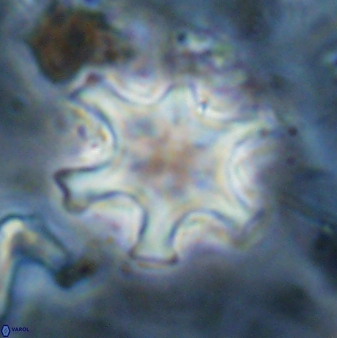 Discoaster sanmiguelensis 32228