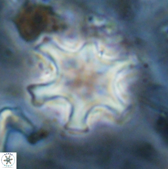 Discoaster sanmiguelensis 32228