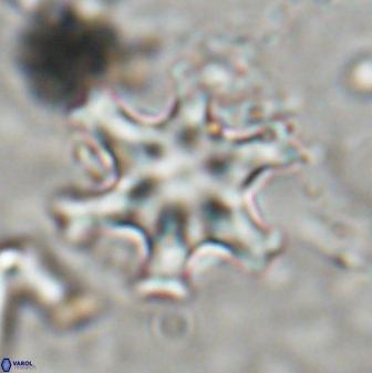 Discoaster sanmiguelensis 32220