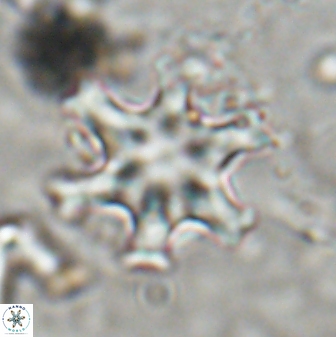 Discoaster sanmiguelensis 32220