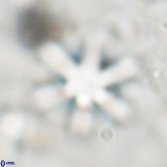 Discoaster sanmiguelensis 32230