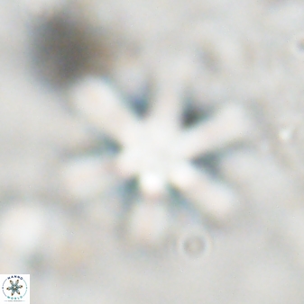Discoaster sanmiguelensis 32230