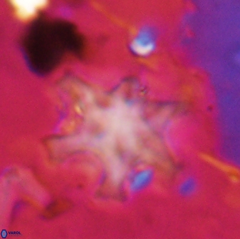 Discoaster sanmiguelensis 32231