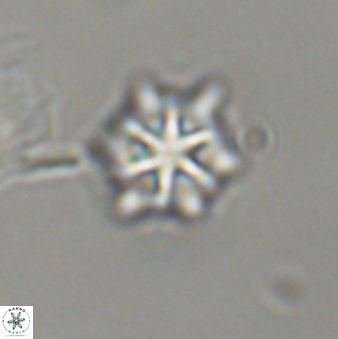 Discoaster self trailliae 32068
