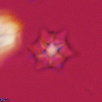 Discoaster self trailliae 32069