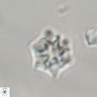 Discoaster self trailliae 32075