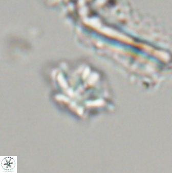 Discoaster self trailiae 32156