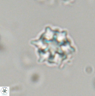 Discoaster self trailliae 32079