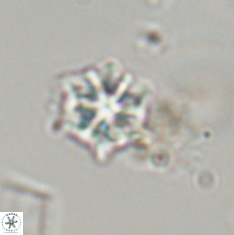 Discoaster self trailliae 32085