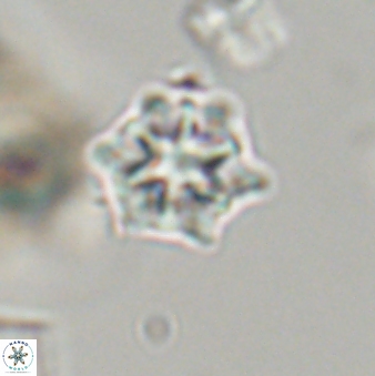Discoaster self trailliae 32088