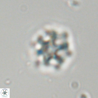 Discoaster self trailliae 32114