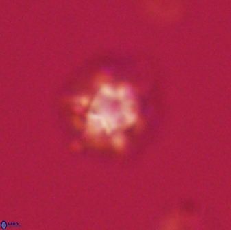 Discoaster self trailliae 32115