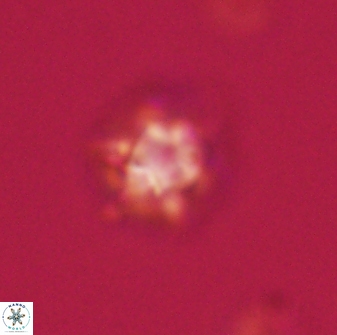 Discoaster self trailliae 32115