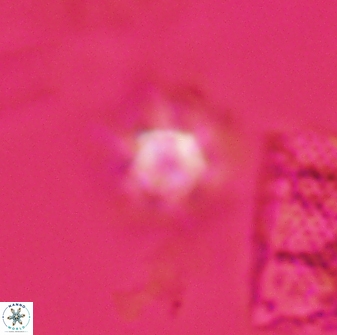 Discoaster self trailliae 32144