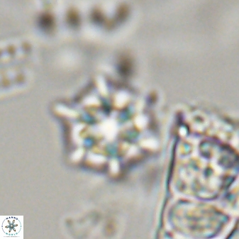 Discoaster self trailliae 32140