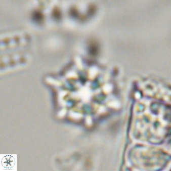 Discoaster self trailliae 32142