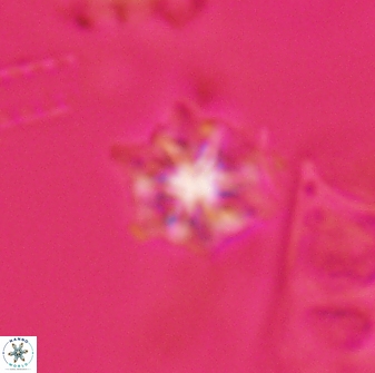 Discoaster self trailliae 32143