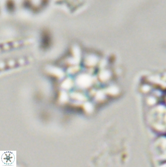 Discoaster self trailliae 32155
