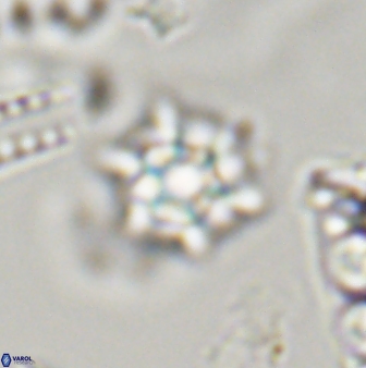 Discoaster self trailliae 32156