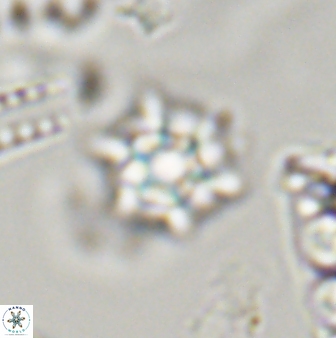 Discoaster self trailliae 32156