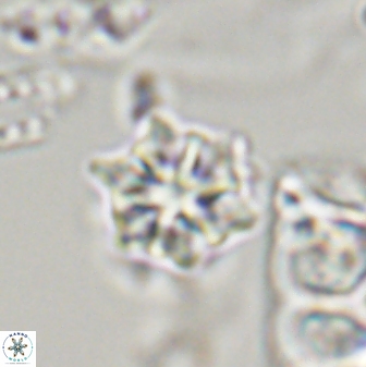 Discoaster self trailliae 32151