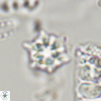 Discoaster self trailliae 32152
