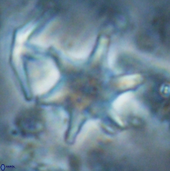 Discoaster shumenkoi 27003