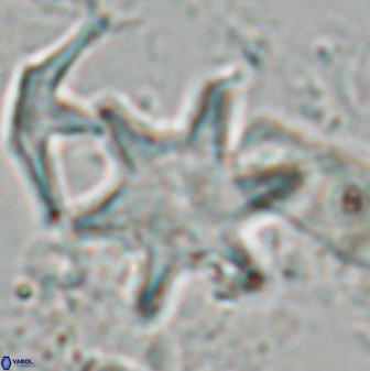 Discoaster shumenkoi 27001