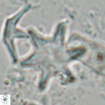 Discoaster shumenkoi 27001