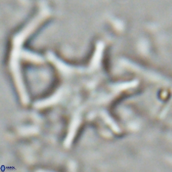 Discoaster shumenkoi 27002